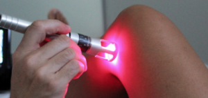 laser terapia Milano